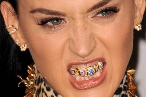 La mode de l’appareil dentaire : WTF ?!